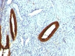 Cytokeratin 19 Antibody (KRT19/800), Novus Biologicals 0.1mg; Unlabeled:Antibodies,