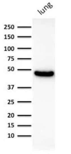 Cytokeratin 19 Antibody (KRT19/800), Novus Biologicals 0.1mg; Unlabeled:Antibodies,