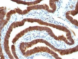 Cytokeratin 19 Antibody (Ks19.1), Novus Biologicals:Antibodies:Primary
