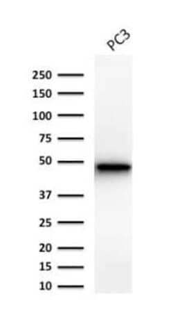 Cytokeratin 19 Antibody (Ks19.1), Novus Biologicals:Antibodies:Primary