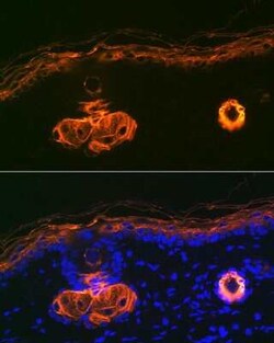 Cytokeratin 2 Rabbit anti-Human, Mouse, Rat, Clone: 9T3Q2, Novus Biologicals 100 &mu;g | Buy Online | Bio-Techne | Fisher Scientific
