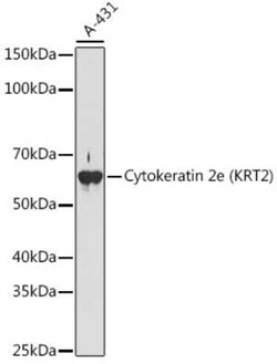 Cytokeratin 2 Rabbit anti-Human, Mouse, Rat, Clone: 9T3Q2, Novus Biologicals 100 &mu;g | Buy Online | Bio-Techne | Fisher Scientific