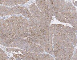 Cytokeratin 2 Antibody, Novus Biologicals:Antibodies:Primary Antibodies