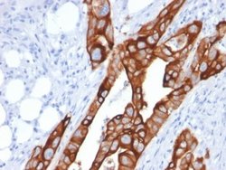 Cytokeratin 20 Antibody (KRT20/1991) - Azide and BSA Free, Novus Biologicals 100 &mu;g | Buy Online | Novus Biologicals | Fisher Scientific