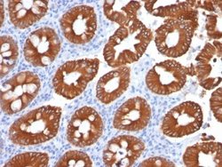 Cytokeratin 20 Antibody (KRT20/1991) - Azide and BSA Free, Novus Biologicals 100 &mu;g | Buy Online | Novus Biologicals | Fisher Scientific