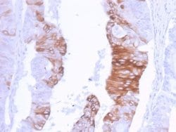 Cytokeratin 20 Antibody (KRT20/3129R) - Azide and BSA Free, Novus Biologicals 100 &mu;g | Buy Online | Novus Biologicals | Fisher Scientific