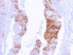 Cytokeratin 20 Rabbit anti-Human, Clone: KRT20/3129R, Novus Biologicals:Antibodies:Primary