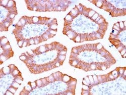 Cytokeratin 20 Rabbit anti-Human, Clone: KRT20/3129R, Novus Biologicals:Antibodies:Primary