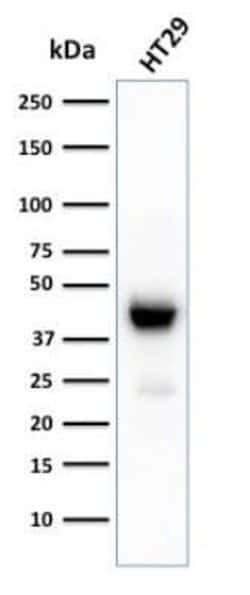 Cytokeratin 20 Rabbit anti-Human, Clone: KRT20/3129R, Novus Biologicals:Antibodies:Primary