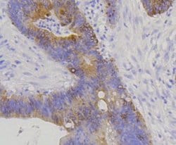 Cytokeratin 20 Antibody (SA35-03), Novus Biologicals 100&mu;L:Antibodies,