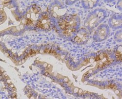 Cytokeratin 20 Antibody (SA35-03), Novus Biologicals 100&mu;L:Antibodies,
