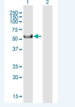 Cytokeratin 39 Antibody, Novus Biologicals 50 &mu;g; Unconjugated:Antibodies,