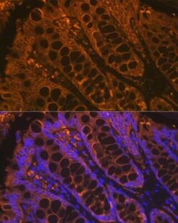 Cytokeratin 4 Rabbit anti-Human, Mouse, Rat, Clone: 6H9R6, Novus Biologicals