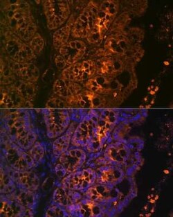 Cytokeratin 4 Rabbit anti-Human, Mouse, Rat, Clone: 6H9R6, Novus Biologicals