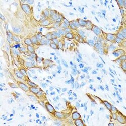 Cytokeratin 4 Rabbit anti-Human, Mouse, Rat, Clone: 6H9R6, Novus Biologicals
