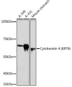 Cytokeratin 4 Rabbit anti-Human, Mouse, Rat, Clone: 6H9R6, Novus Biologicals