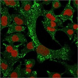 Cytokeratin 4 Antibody (KRT4/2804) - Azide and BSA Free, Novus Biologicals
