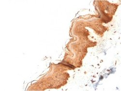 Cytokeratin 4 Antibody (KRT4/2804) - Azide and BSA Free, Novus Biologicals