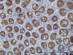 Cytokeratin 4 Antibody (5H5), Novus Biologicals 0.1 mg, Unconjugated:Antibodies,