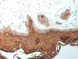 Cytokeratin 5/6/18 Mouse anti-Human, Rat, Bovine, Clone: SPM267, Novus Biologicals 20 &mu;g | Buy Online | Novus Biologicals | Fisher Scientific