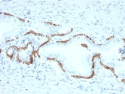 Cytokeratin 5/6 Mouse anti-Human, Clone: KRT5.6/2438, Novus Biologicals:Antibodies:Primary