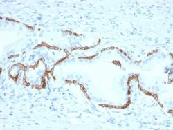 Cytokeratin 5/6 Antibody (KRT5.6/2438) - Azide and BSA Free, Novus Biologicals 100 &mu;g | Buy Online | Novus Biologicals | Fisher Scientific