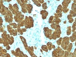 Cytokeratin 5/6 Antibody (KRT5.6/2438) - Azide and BSA Free, Novus Biologicals 100 &mu;g | Buy Online | Novus Biologicals | Fisher Scientific