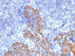 Cytokeratin 5/6 Antibody (KRT5.6/2438) - Azide and BSA Free, Novus Biologicals 100 &mu;g | Buy Online | Novus Biologicals | Fisher Scientific