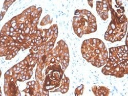 Cytokeratin 5/6 Antibody (KRT5.6/4866) - Azide and BSA Free, Novus Biologicals 100 &mu;g | Buy Online | Novus Biologicals | Fisher Scientific