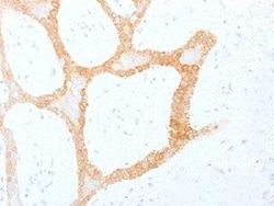 Cytokeratin 5/8 Antibody (C-50), Novus Biologicals 0.02 mg | Buy Online | Novus Biologicals | Fisher Scientific
