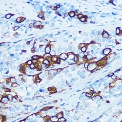 Cytokeratin 5 Rabbit anti-Human, Mouse, Rat, Clone: 3P3T9, Novus Biologicals