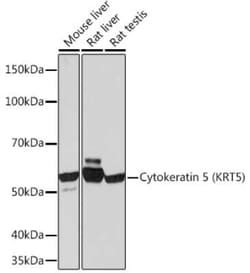 Cytokeratin 5 Rabbit anti-Human, Mouse, Rat, Clone: 3P3T9, Novus Biologicals