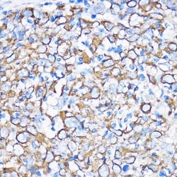 Cytokeratin 5 Antibody - Azide and BSA Free, Novus Biologicals:Antibodies:Primary