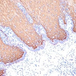 Cytokeratin 6 Rabbit anti-Human, Clone: 3F7A1, Novus Biologicals 100 &mu;g;