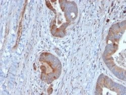 Cytokeratin 6 Antibody (KRT6B/2116) - Azide and BSA Free, Novus Biologicals