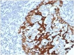 Cytokeratin 6a Rabbit anti-Human, Clone: KRT6/3997R, Novus Biologicals:Antibodies:Primary