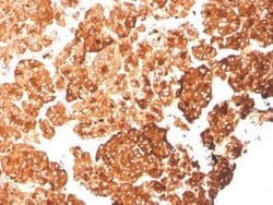 Cytokeratin 6a Mouse anti-Human, Clone: rKRT6A/2100, Novus Biologicals