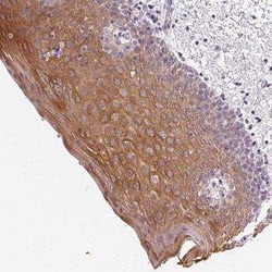 Cytokeratin 6a Antibody, Novus Biologicals 25 &mu;L, Unconjugated:Antibodies,