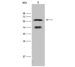 Cytokeratin 6a Antibody, Novus Biologicals™