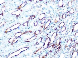 Cytokeratin 7 Rabbit anti-Human, Mouse, Rat, Clone: 5V4M10, Novus Biologicals 20 &mu;g | Buy Online | Novus Biologicals | Fisher Scientific