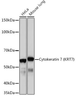 Cytokeratin 7 Rabbit anti-Human, Mouse, Rat, Clone: 5V4M10, Novus Biologicals 20 &mu;g | Buy Online | Novus Biologicals | Fisher Scientific