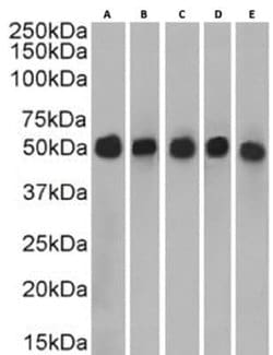Cytokeratin 7 Rabbit anti-Human, Clone: OV-TL 12/30, Novus Biologicals:Antibodies:Primary