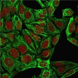 Cytokeratin 7 Antibody (K72.7), Novus Biologicals 0.1mg; Unlabeled:Antibodies,