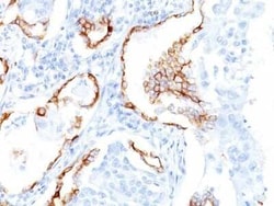 Cytokeratin 7 Antibody (K72.7), Novus Biologicals 0.1mg; Unlabeled:Antibodies,