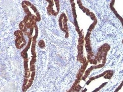 Cytokeratin 7 Antibody (K72.7), Novus Biologicals 0.1mg; Unlabeled:Antibodies,