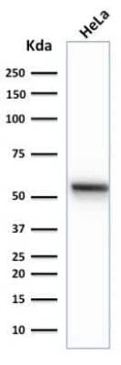Cytokeratin 7 Antibody (K72.7), Novus Biologicals 0.1mg; Unlabeled:Antibodies,