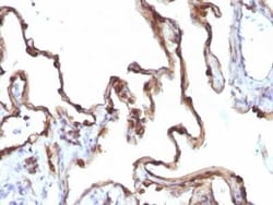Cytokeratin 7 Antibody (KRT7/1198), Novus Biologicals:Antibodies:Primary