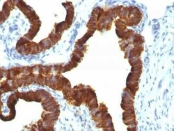 Cytokeratin 7 Antibody (KRT7/1198), Novus Biologicals:Antibodies:Primary