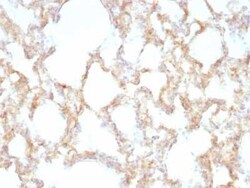 Cytokeratin 7 Antibody (KRT7/1198), Novus Biologicals:Antibodies:Primary