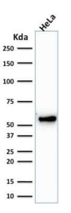 Cytokeratin 7 Antibody (KRT7/1198), Novus Biologicals:Antibodies:Primary